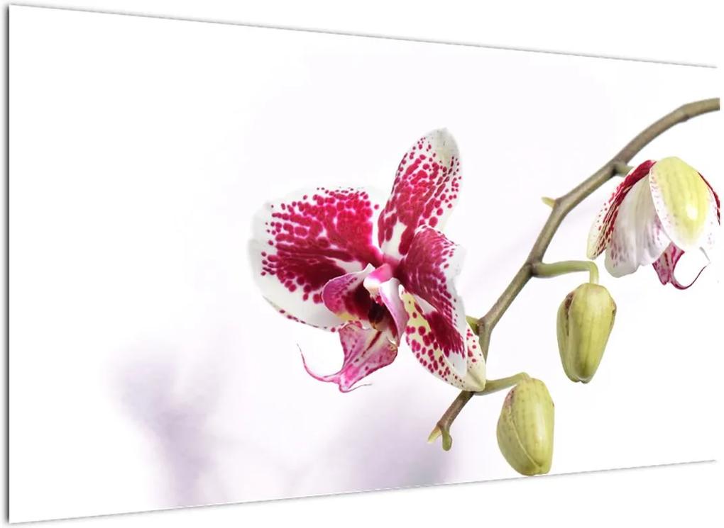 Schilderij - Orchideebloesem (), 40 andere afmetingen